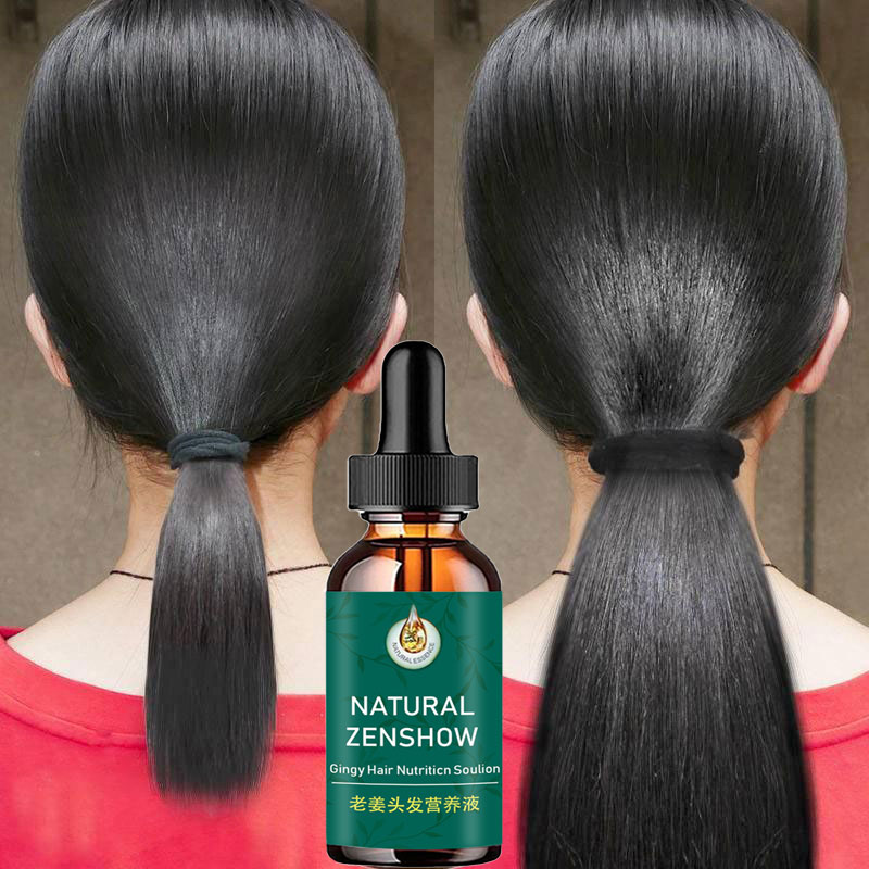Hair Care Herbal Products - Ingwer Haarwuchs ätherisches Öl Kräuter Haarpflege