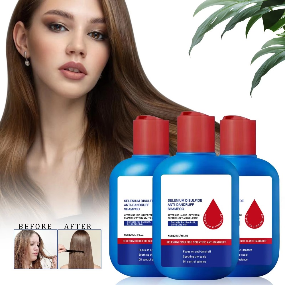 Hair Care Dandruff - Neues 120ml Nipori Shampoo zur Ölkontrolle