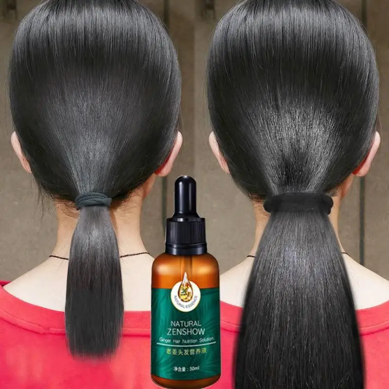 Ingwer Haarwuchs ätherisches Ö – Hair Care Herbal Products Bewertung und Preis