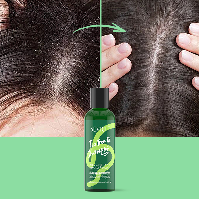 Tea Tree Essence Shampoo Haars – Hair Care Set Bewertung und Preis