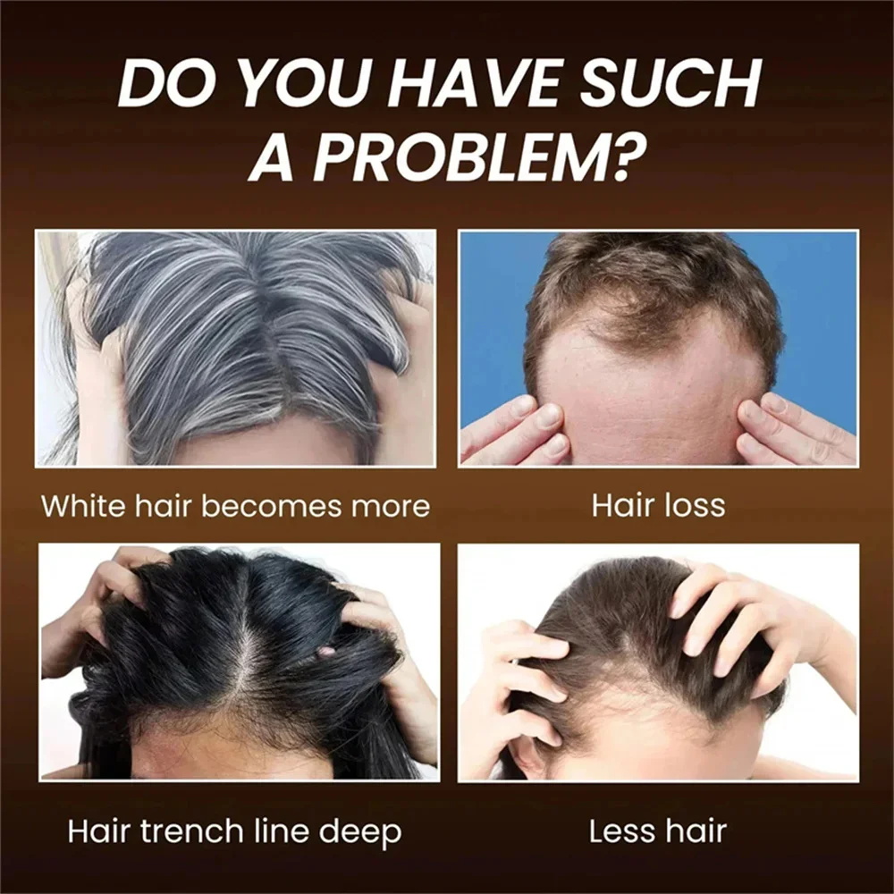Kräuter-Anti-Grau-Haar-Behandl – Hair Care Herbal Products Bewertung und Preis