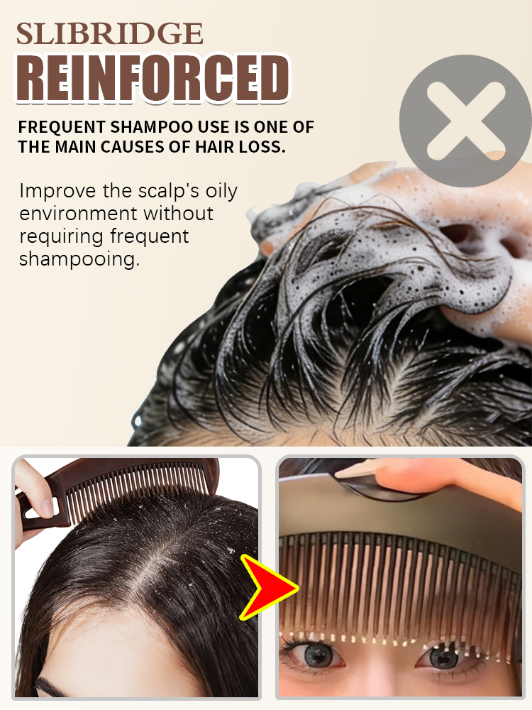 Kopfhaut-Öl-Entfernungs-Kamm,  – Hair Care Dandruff Bewertung und Preis